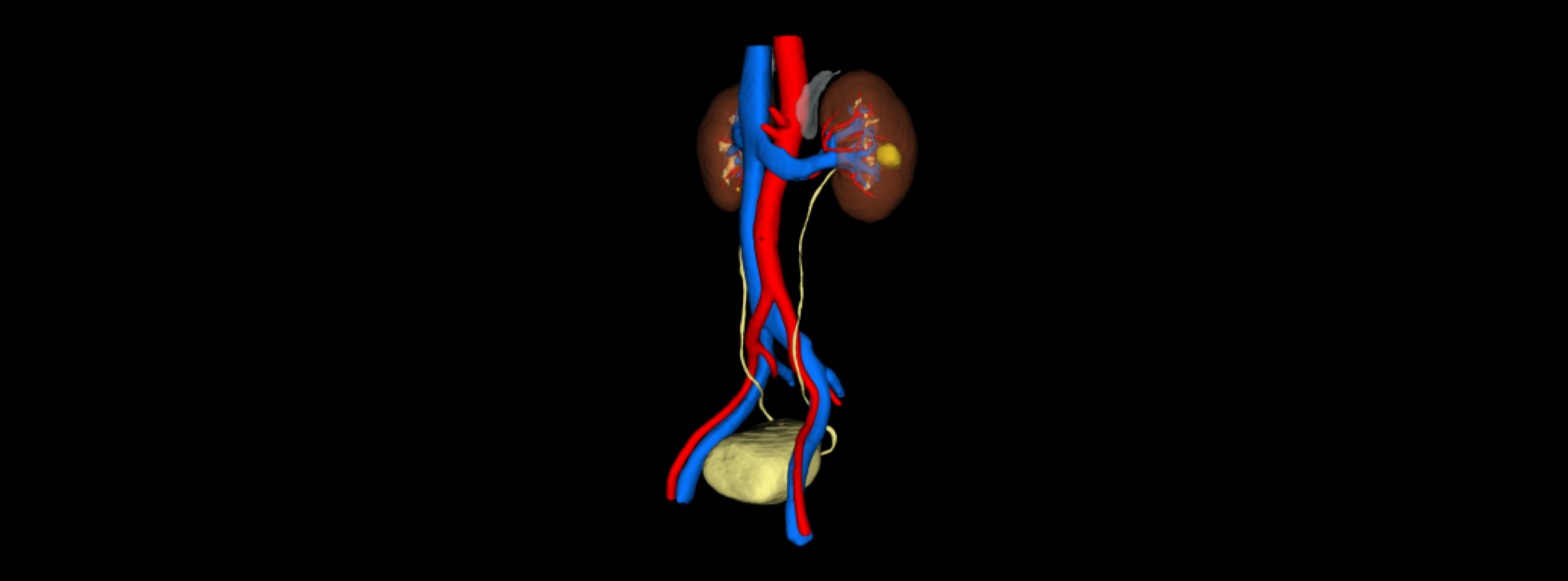 精准三维重建肾实质、肾肿瘤、肾动脉、肾静脉和集合系统