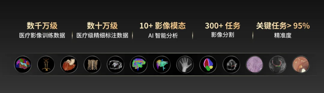 千万级影像数据淬炼,联影智能AI医疗影像大模型持续释放技术价值