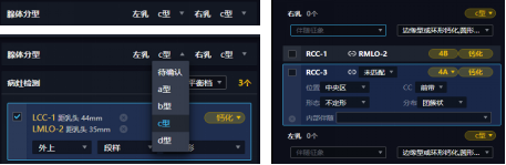 联影智能乳腺AI人工智能分析系统助力乳腺癌早筛