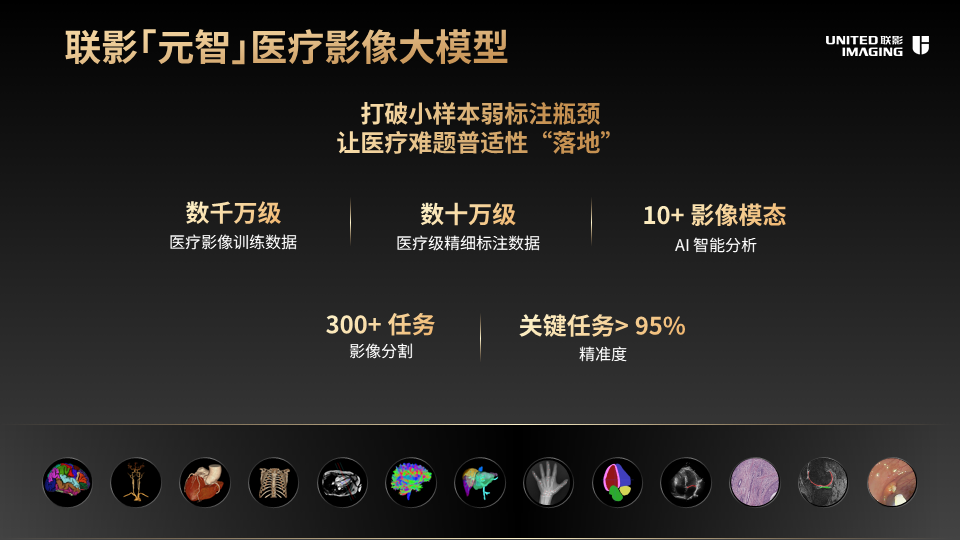 联影智能医疗影像大模型：赋能临床，提升诊断效能